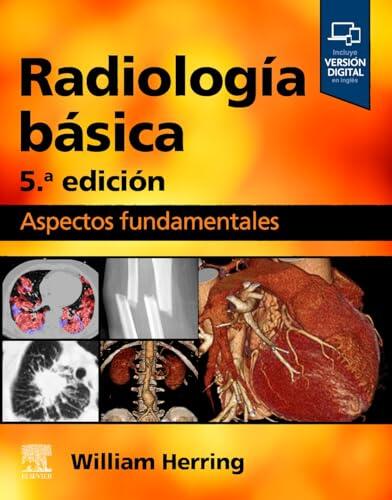 Dominando la Radiología: Guía Esencial para la Interpretación Médica