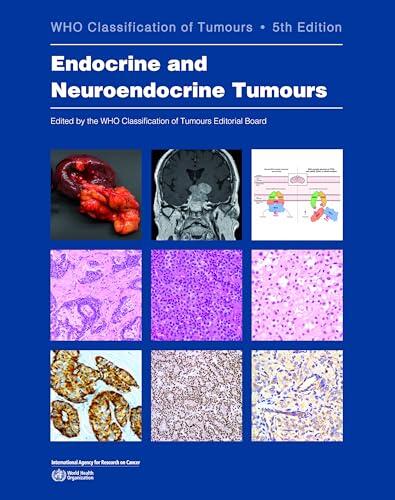 El estándar de oro en el diagnóstico de tumores endocrinos: guía definitiva 5ª edición