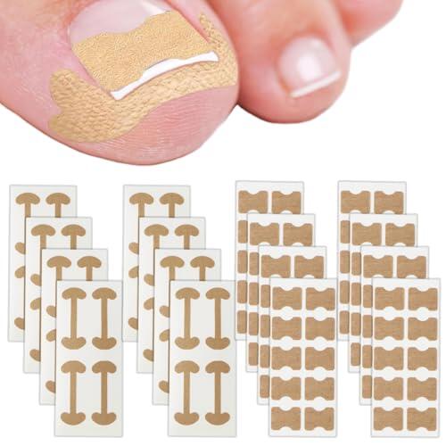 Kit de 112 piezas para uñas encarnadas, kit de corrección de uñas encarnadas, kit de tratamiento para uñas encarnadas