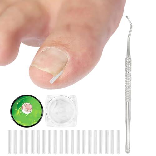 Juego de correctores para uñas encarnadas, 50 tiras alisadoras de uñas sin dolor con elevador de uñas, kit de herramientas para uñas encarnadas de fácil uso