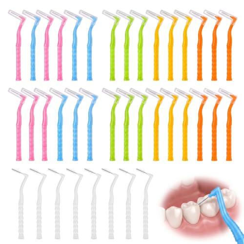 La Guía Definitiva para una Higiene Interdental Profunda y el Cuidado de Ortodoncia